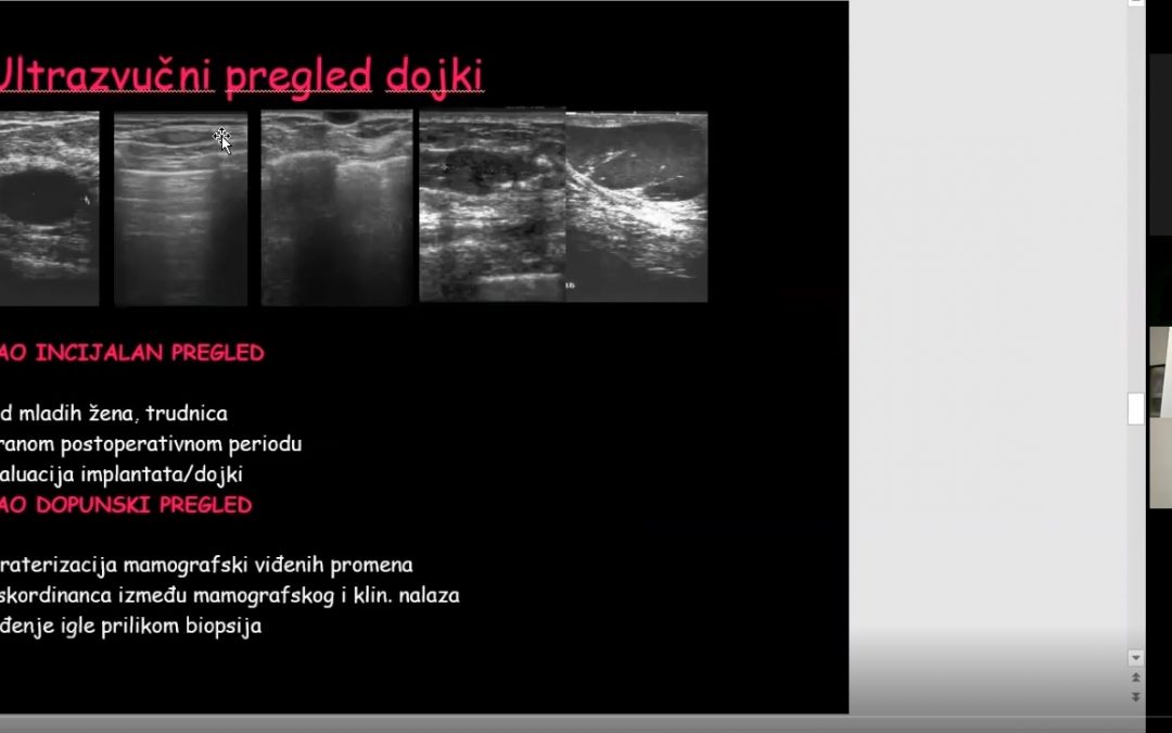 Doc. dr Nataša Prvulović Bunović – Videokonferencija – Savremene metode pregleda i biopsija dojki,